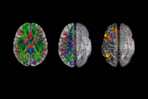 Three brain models: colorful fiber tracts, blue neural network overlay, and functional activity with red network.